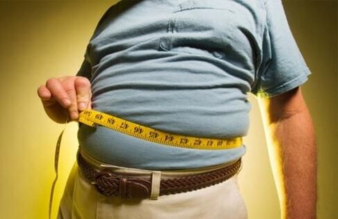 L'eccesso di peso provoca lo sviluppo di vene varicose